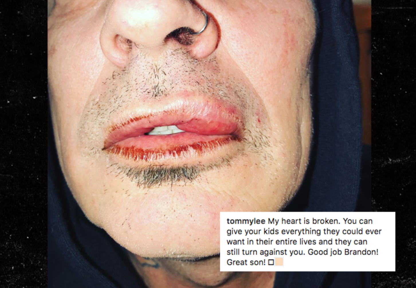 Tommy Lee says he was assaulted by his son | Metal Insider