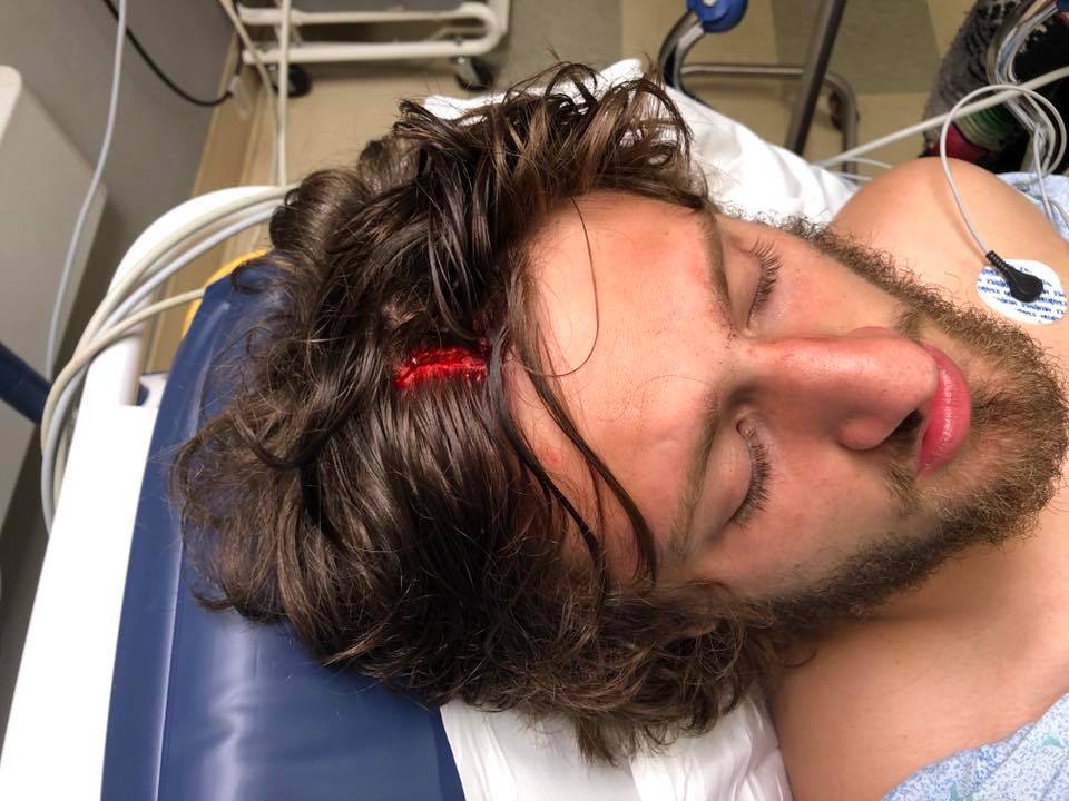 New Jersey hardcore band TRNQT accused of seriously injuring fan at show