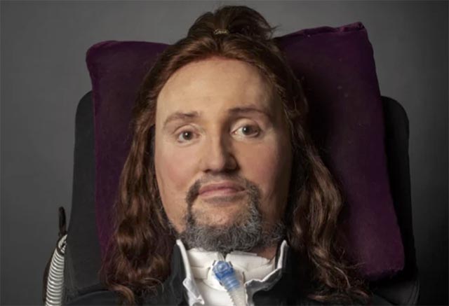Jason Becker hospitalized after experiencing “shortness of breath and a rapid heart rate”